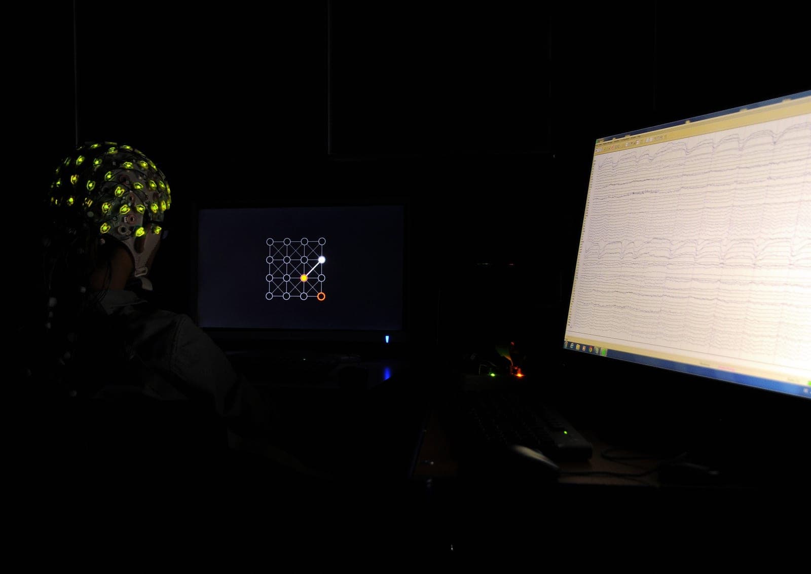 China acelera los implantes cerebrales con inteligencia artificial